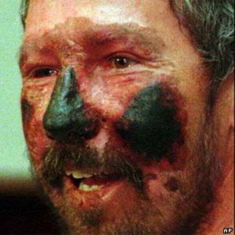 Beck Weathers is trapped in the blizzard.