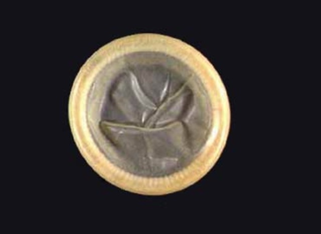 Preservativos o condones