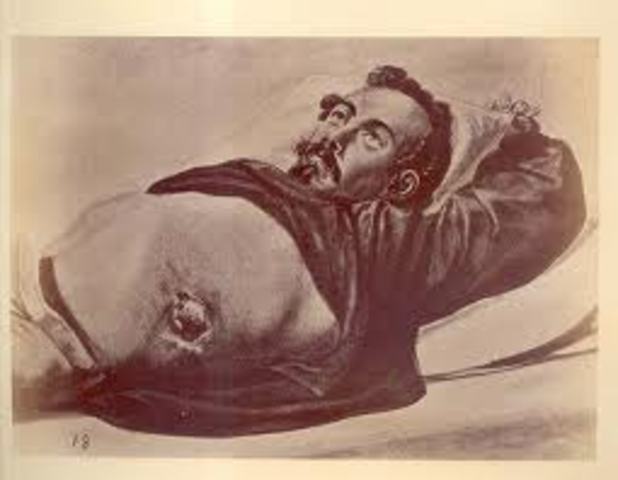 O'Brien gets shot for the first time