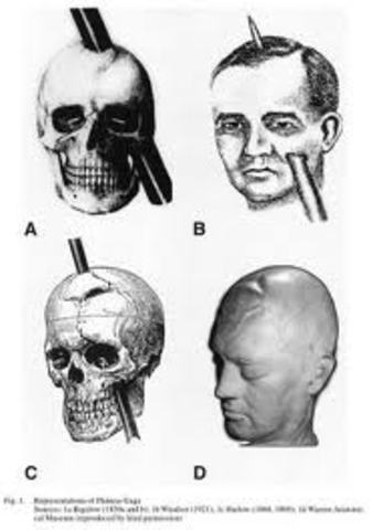El Dolor de cabeza de Phineas Gage
