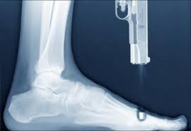 Rat Kiley shoots himself in the foot