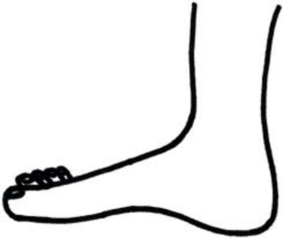 Kiowa gets shot in the foot. (pg.212) Quote: The next morning he shot himself, he took off his boots and socks, laid out his medical ki,doped himself up and put a round through his foot.