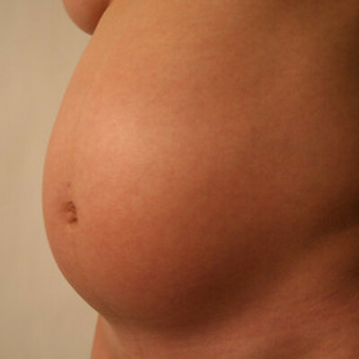 Timeline: Thanet's Teen Pregnancy History