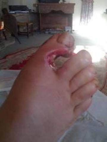 Rat Kiley shoots himself in the foot