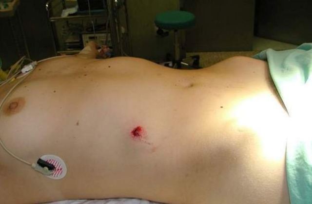 O'Brien gets shot: First time