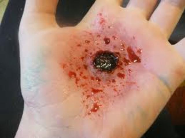 O'Briens first time getting shot