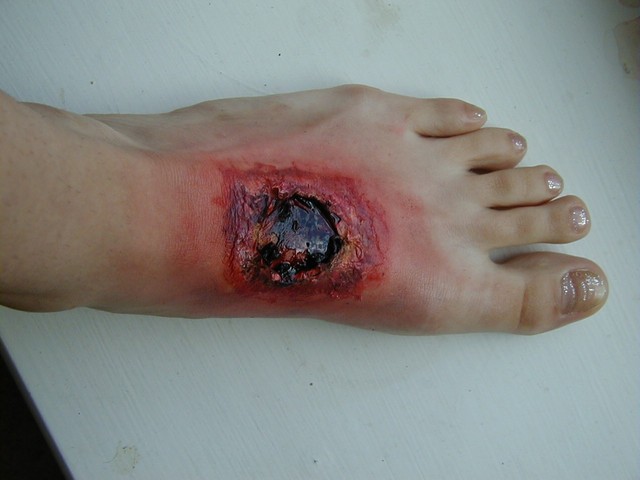 Rat Killey shoots himself in the foot