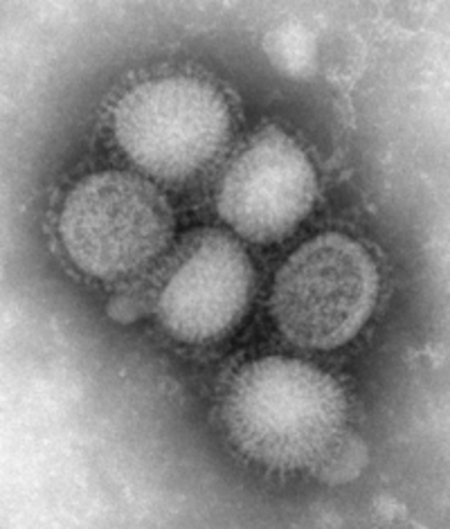 El brote del Virus AH1N1