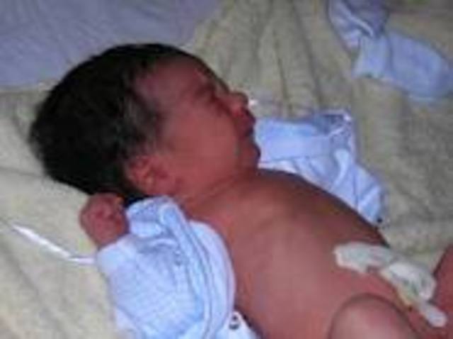 RIESGO DE EMBARAZO ADOLESCENTE