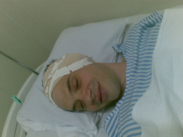 Stephen's Cochlear Implant Surgery