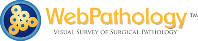 Imagenes histolgógicas de WebPathology.com