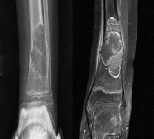 Imagenología de los Trastornos Óseos
