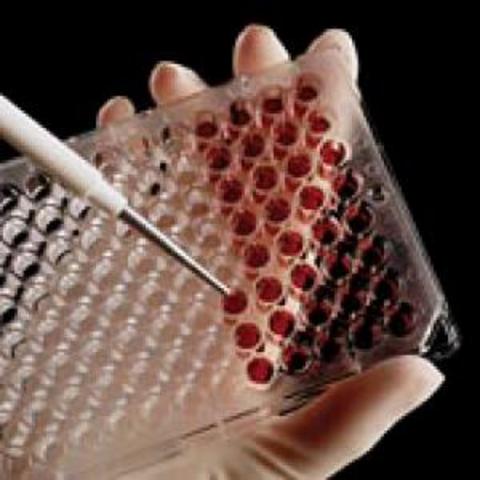 World AIDS Day announced 3 by 5 Plan