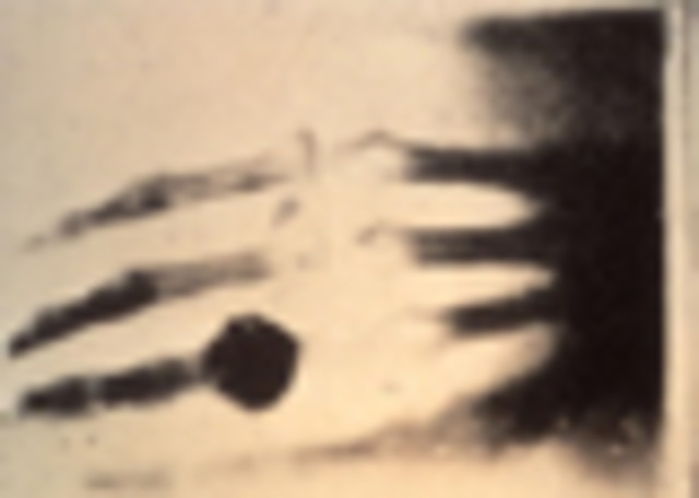 découverte des rayons X par le physicien allemand W. Röntgen