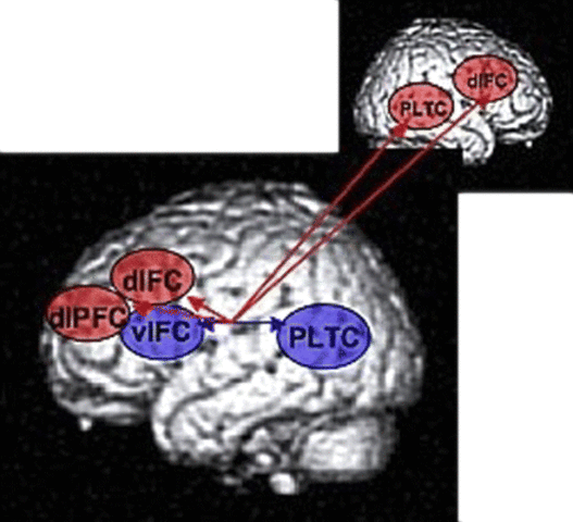 LSD Chromosome Damage
