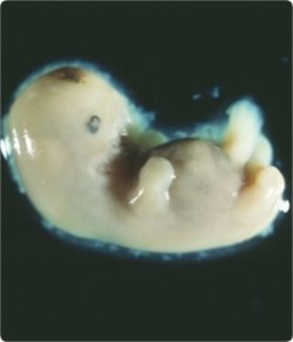 Prenatal - Embryonic Period