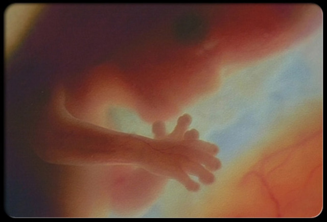 Prenatal Fetal Period- First 3 months