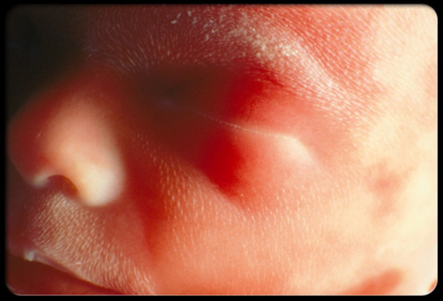 Prenatal - Fetal Period- middle three months