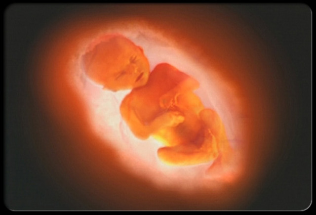 Prenatal - fetal period- Final three months