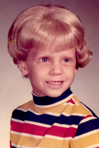 Diagnosed with Retinoblastoma- lost eye.