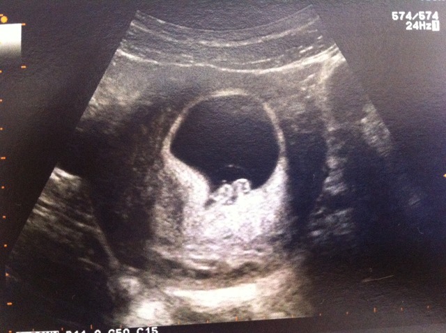 Echo de datation NOMADE