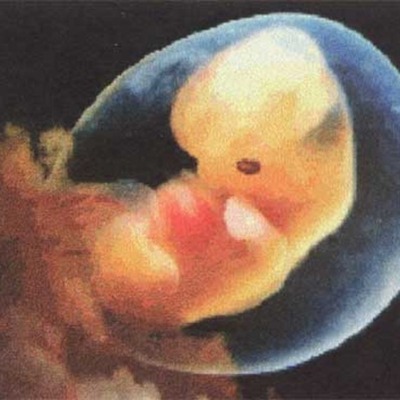 Timeline: Trimester 1