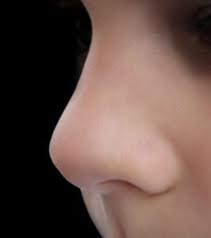 Intervensión Médica.