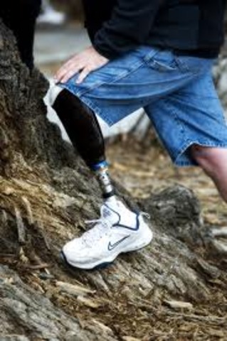 Prosthetics