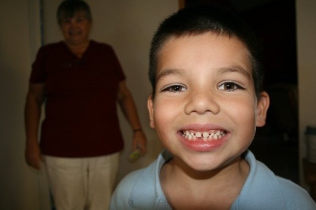 I lost my first tooth!