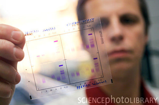 Immunoelectrophoretic Technique