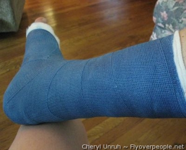 daddy broke foot playing softball