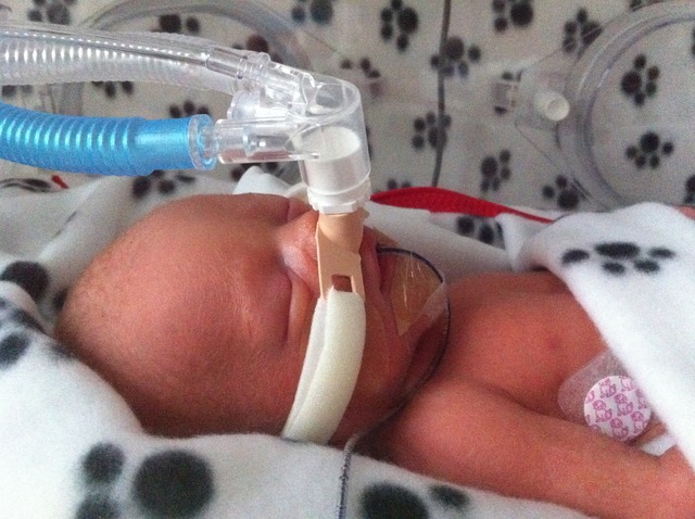 Austin was born 2 months pre-maturely