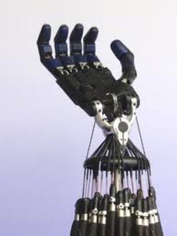 The Robotic Hand