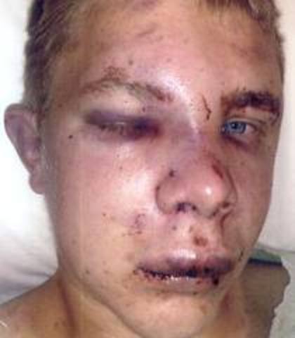 Colin sees ted bashed