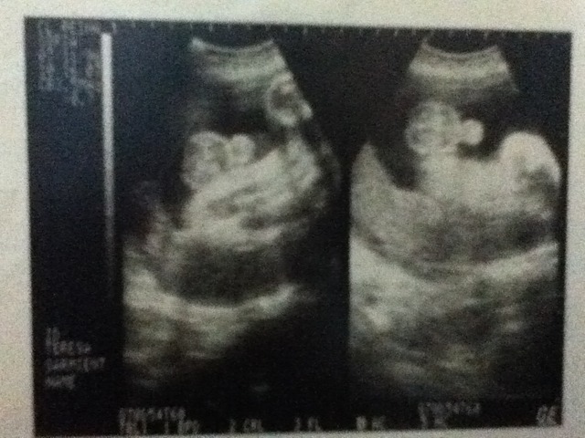 Primera vez que me vieron en fabuloso 2d