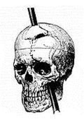 Phineas Gage Personality breakthrough
