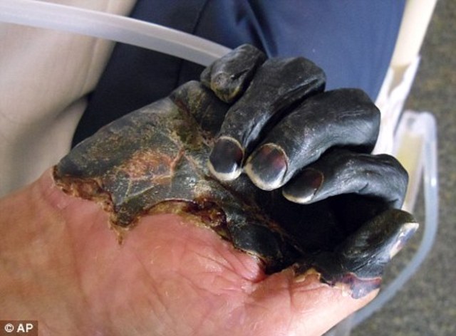 Bubonic Plague first hits Europe