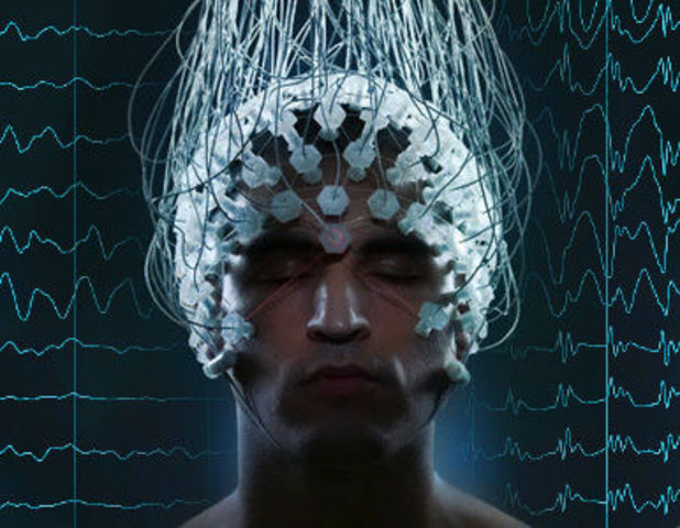 Electroencefalografía