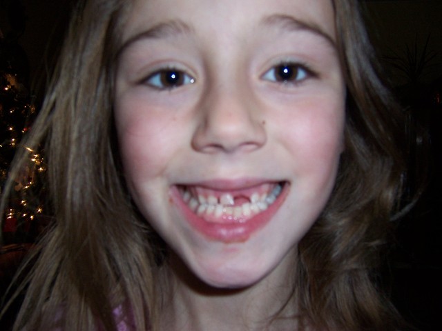 lost my first tooth