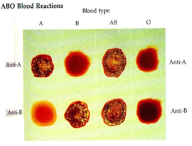 Blood test