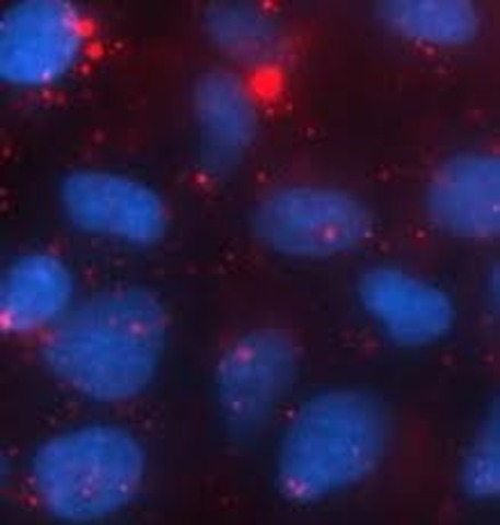 specific antigens into body fluid