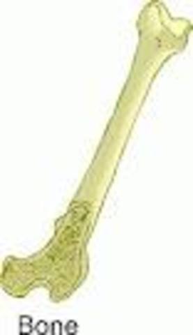 My bone came out of the correct place!