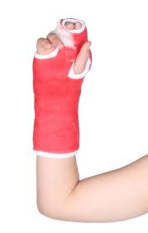 I broke my left arm.