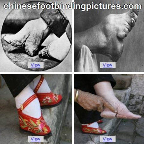 Foot Binding