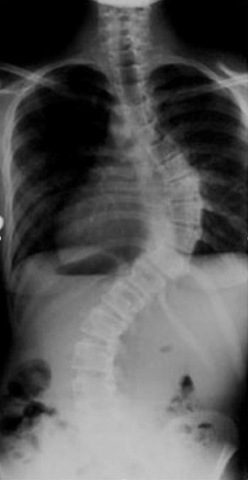 The Day I Had Surgery