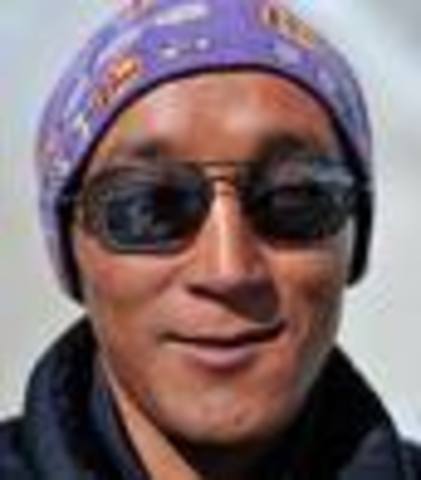 Nawang sick with edema, very sick