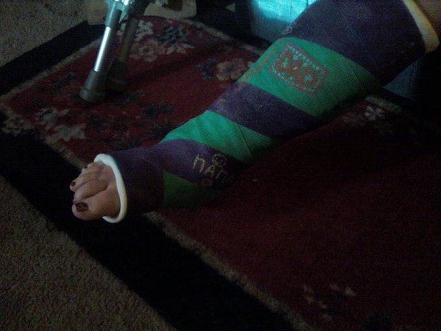 First Broken Bone