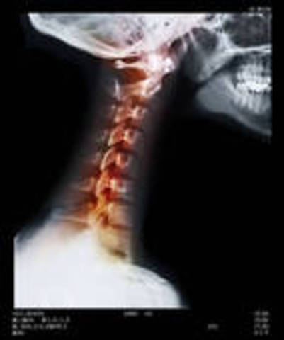 Di Toro's inflamed neck affected her again