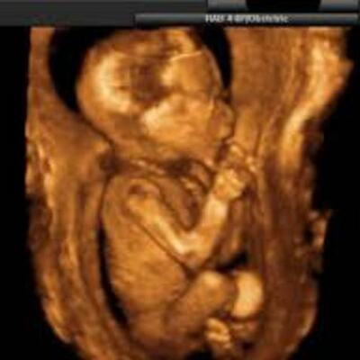 Timeline: Month 1- Mommy