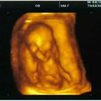 Timeline: Pregancy And Prenatal Dev.